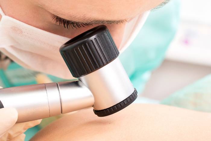 Una formación médica adecuada es clave para la prevención y detección precoz del melanoma