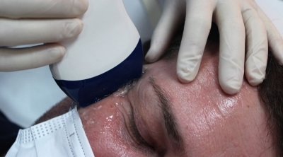 Taller Práctico presencial de Ecografía Aplicada a la Medicina Estética el 25 de septiembre, en grupo reducido