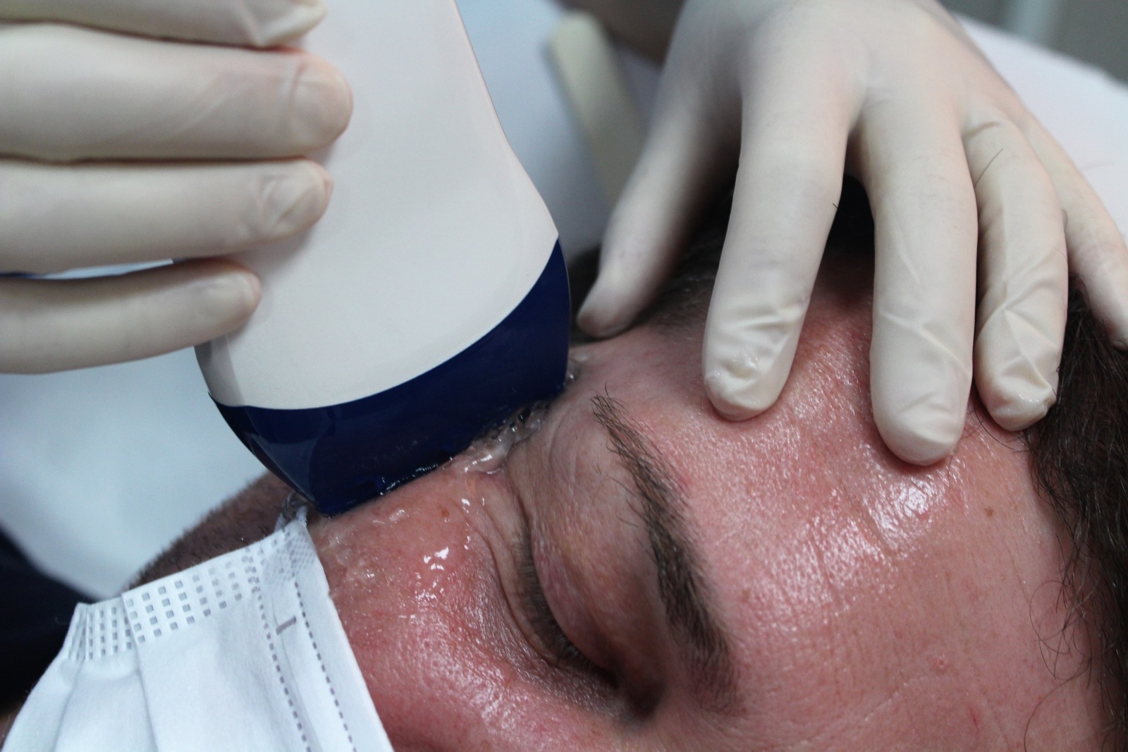 Taller Práctico presencial de Ecografía Aplicada a la Medicina Estética el 20 de marzo, en grupo reducido