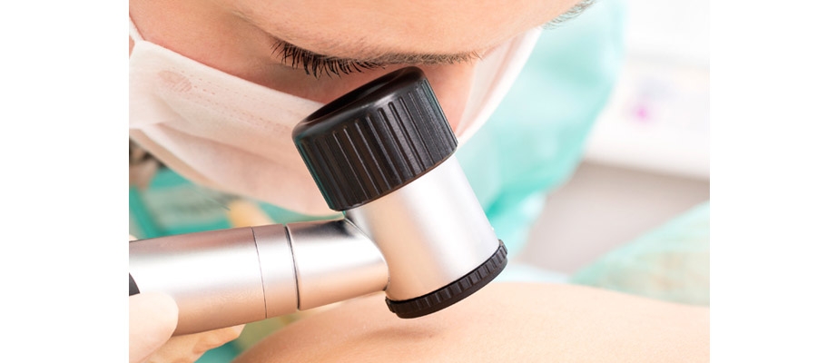 Formación MBL reivindica el papel de los médicos estéticos en la prevención del cáncer de piel